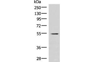 Western blot analysis of Human heart tissue lysate using IRX1 Polyclonal Antibody at dilution of 1:300 (IRX1 antibody)