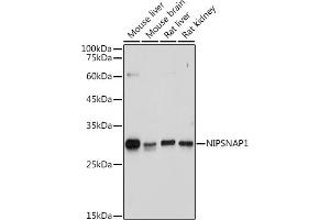 Western blot analysis of extracts of various cell lines, using NIPSN antibody (ABIN7265337) at 1:1000 dilution. (NIPSNAP1 antibody)