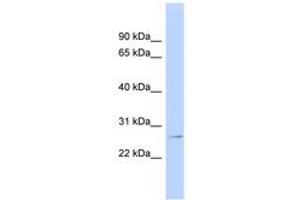 Image no. 1 for anti-Glutathione S-Transferase pi 1 (GSTP1) (AA 35-84) antibody (ABIN6743477) (GSTP1 antibody  (AA 35-84))
