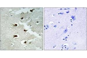 Immunohistochemistry analysis of paraffin-embedded human brain tissue, using CDCA4 Antibody. (CDCA4 antibody  (AA 121-170))