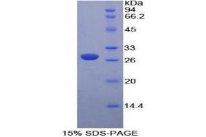 SDS-PAGE (SDS) image for Pyruvate Kinase, Liver and RBC (PKLR) (AA 114-323) protein (His tag) (ABIN2126600)