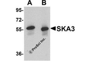 Western Blotting (WB) image for anti-Spindle and Kinetochore Associated Complex Subunit 3 (SKA3) (C-Term) antibody (ABIN1030668) (SKA3 antibody  (C-Term))