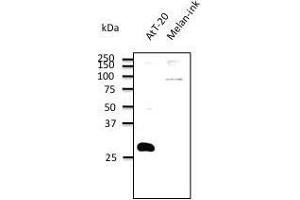 Anti. (RAB27B antibody  (C-Term))