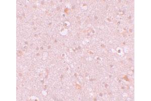 Immunohistochemical staining of human brain cells with CXXC4 polyclonal antibody  at 10 ug/mL. (CXXC4 antibody  (N-Term))