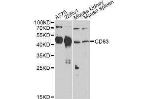 Western blot analysis of extracts of various cell lines, using CD63 Antibody (ABIN5974980) at 1/1000 dilution. (CD63 antibody)