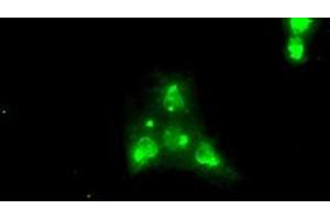 Image no. 2 for anti-Neurotrophic tyrosine Kinase, Receptor, Type 3 (NTRK3) antibody (ABIN1499841)