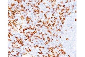 IHC testing of human tonsil (20X) stained with CD8a antibody (C8/468). (CD8 alpha antibody)
