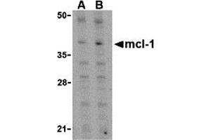 Western Blotting (WB) image for anti-Induced Myeloid Leukemia Cell Differentiation Protein Mcl-1 (MCL1) (C-Term) antibody (ABIN1030511) (MCL-1 antibody  (C-Term))