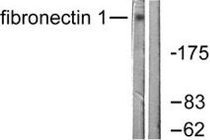 Western blot analysis of extracts from HeLa cells, using Fibronectin 1 Antibody. (Fibronectin 1 antibody  (AA 2337-2386))