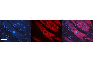 Rabbit Anti-SNX1 Antibody   Formalin Fixed Paraffin Embedded Tissue: Human heart Tissue Observed Staining: Cytoplasmic Primary Antibody Concentration: 1:100 Other Working Concentrations: N/A Secondary Antibody: Donkey anti-Rabbit-Cy3 Secondary Antibody Concentration: 1:200 Magnification: 20X Exposure Time: 0. (Sorting Nexin 1 antibody  (C-Term))