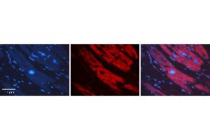 Rabbit Anti-SNX1 Antibody   Formalin Fixed Paraffin Embedded Tissue: Human heart Tissue Observed Staining: Cytoplasmic Primary Antibody Concentration: 1:100 Other Working Concentrations: N/A Secondary Antibody: Donkey anti-Rabbit-Cy3 Secondary Antibody Concentration: 1:200 Magnification: 20X Exposure Time: 0. (Sorting Nexin 1 antibody  (C-Term))