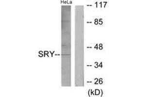 Western blot analysis of extracts from HeLa cells, using SRY Antibody. (SRY antibody  (AA 51-100))