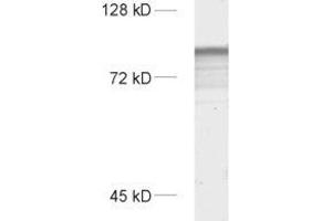 dilution: 1 : 1000, sample: rat brain homogenate (SYNPO antibody  (Isoform 2))
