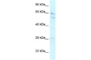 Western Blot showing RBBP5 antibody used at a concentration of 1.