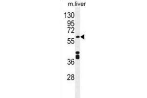 Western Blotting (WB) image for anti-Cytochrome P450, Family 1, Subfamily A, Polypeptide 2 (CYP1A2) antibody (ABIN2996139)