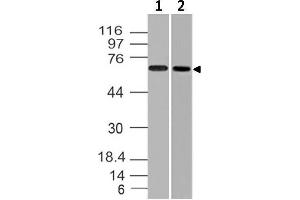 Image no. 1 for anti-Endoglin (ENG) (AA 43-287) antibody (ABIN5027187) (Endoglin antibody  (AA 43-287))