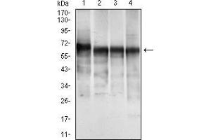 Western blot analysis using CK5 mouse mAb against A431 (1), MCF-7 (2), Hela (3) and HepG2 (4) cell lysate. (Cytokeratin 5 antibody  (AA 316-590))