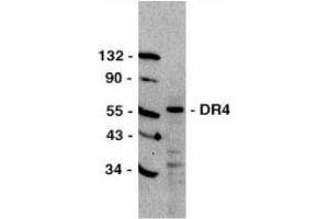 Western Blotting (WB) image for anti-Tumor Necrosis Factor Receptor Superfamily, Member 10a (TNFRSF10A) (C-Term) antibody (ABIN2479547) (TNFRSF10A antibody  (C-Term))