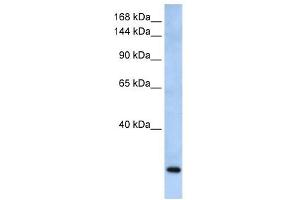 FBXW10 antibody used at 1 ug/ml to detect target protein. (FBXW10 antibody  (Middle Region))