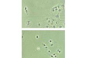 Immunohistochemistry. (NF-kB p65 antibody  (N-Term, NLS Domain))