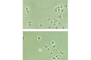 Immunohistochemistry. (NF-kB p65 antibody  (N-Term, NLS Domain))