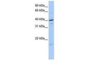 Image no. 1 for anti-Tubulin Polymerization-Promoting Protein Family Member 3 (TPPP3) (C-Term) antibody (ABIN6740766)