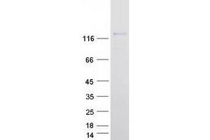 AGLU Protein (Transcript Variant 3) (Myc-DYKDDDDK Tag)