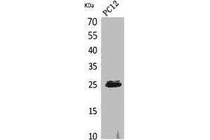 CMTM5 anticorps  (N-Term)