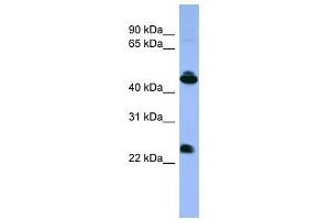 Western Blot showing OPN1MW antibody used at a concentration of 1-2 ug/ml to detect its target protein. (OPN1MW antibody  (C-Term))