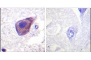 Immunohistochemistry (IHC) image for anti-Guanine Nucleotide Binding Protein (G Protein), alpha Z Polypeptide (GNaZ) (AA 1-50) antibody (ABIN2888875) (GNaZ antibody  (AA 1-50))