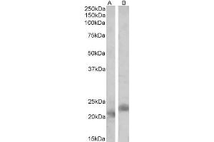 ABIN1590015 (2 µg/mL) staining of Mouse (A) and Rat (B) Spleen lysates (35 µg protein in RIPA buffer). (PYCARD antibody  (Internal Region))