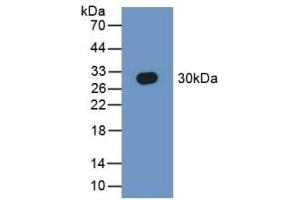 Detection of Recombinant SEPT5, Human using Polyclonal Antibody to Septin 5 (SEPT5) (Septin 5 antibody  (AA 77-323))