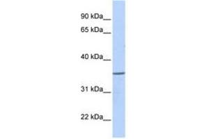 Image no. 1 for anti-Zinc Finger Protein 688 (ZNF688) (AA 108-157) antibody (ABIN6740519)