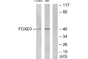Immunohistochemistry analysis of paraffin-embedded human heart tissue using FOXD3 antibody. (FOXD3 antibody)