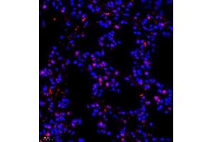 Immunofluorescence of paraffin embedded mouse lung using NSFL1C (ABIN7074865) at dilution of 1:650 (400x lens) (NSFL1C antibody)