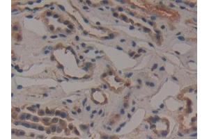 Detection of GCLM in Human Kidney Tissue using Polyclonal Antibody to Glutamate Cysteine Ligase, Modifier Subunit (GCLM)