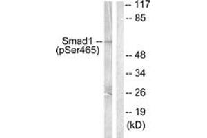 Western blot analysis of extracts from HeLa cells treated with Serum 10% 15', using Smad1 (Phospho-Ser465) Antibody. (SMAD1 antibody  (pSer465))