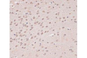 Immunohistochemistry of paraffin-embedded Mouse brain using PRPF31 Polyclonal Antibody at dilution of 1:100 (40x lens).