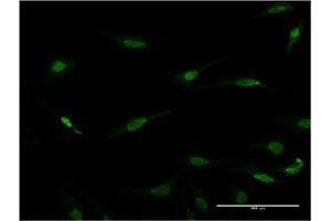 Immunofluorescence of monoclonal antibody to RAX on HeLa cell. (RAX antibody  (AA 253-346))