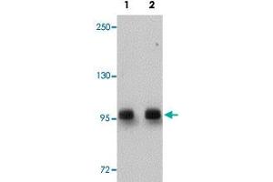 Western blot analysis of rat brain tissue with DCLK2 polyclonal antibody  at (Lane 1) 1 and (Lane 2) 2 ug/mL dilution.