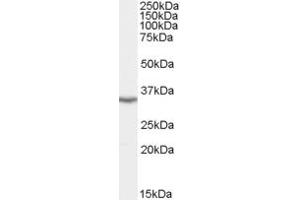 ABIN184658 staining (0. (LASP1 antibody  (N-Term))