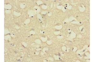 Immunohistochemistry of paraffin-embedded human brain tissue using ABIN7175065 at dilution of 1:100 (C11orf1 antibody  (AA 33-150))