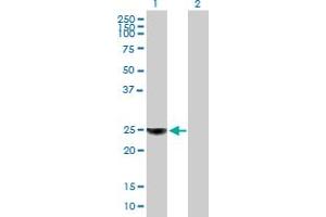 Western Blot analysis of ORM1 expression in transfected 293T cell line by ORM1 MaxPab polyclonal antibody. (ORM1 antibody  (AA 1-201))