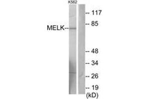 Western blot analysis of extracts from K562 cells, using MELK Antibody. (MELK antibody  (AA 431-480))