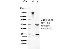 SDS-PAGE Analysis Purified RAD51 Mouse Monoclonal Antibody (RAD51/2702). (RAD51 antibody  (AA 1-134))