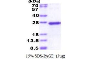 SDS-PAGE (SDS) image for NADH Dehydrogenase (Ubiquinone) Fe-S Protein 5, 15kDa (NADH-Coenzyme Q Reductase) (NDUFS5) (AA 1-106) protein (His tag) (ABIN5853540) (NDUFS5 Protein (AA 1-106) (His tag))