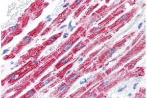 Human Heart (formalin-fixed, paraffin-embedded) stained with FOXA3 antibody ABIN214752 at 5 ug/ml followed by biotinylated goat anti-rabbit IgG secondary antibody ABIN481713, alkaline phosphatase-streptavidin and chromogen. (FOXA3 antibody  (AA 201-250))