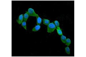 IF analysis of CST3 using anti-CST3 antibody (ABIN6719299). (CST3 antibody  (AA 31-146))