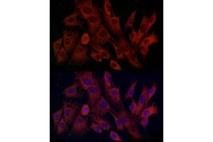 Immunofluorescence analysis of C6 cells using TIMM8A Rabbit pAb (ABIN6129145, ABIN6149172, ABIN6149173 and ABIN6225114) at dilution of 1:100 (40x lens).