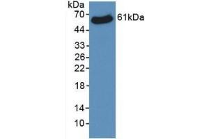 Detection of Recombinant VDAC1, Human using Monoclonal Antibody to Voltage Dependent Anion Channel Protein 1 (VDAC1) (VDAC1 antibody  (AA 2-283))